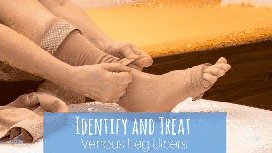 Identify and Treat Venous Leg Ulcers