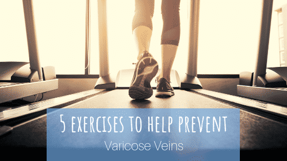 5 Exercises to Prevent Varicose Veins