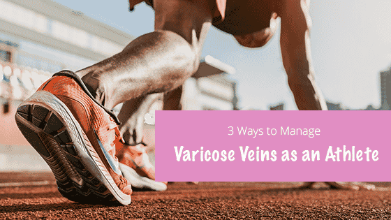  ways to manage varicose veins as an athlete