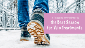 the best season for vein treatments with someone walking away in boots
