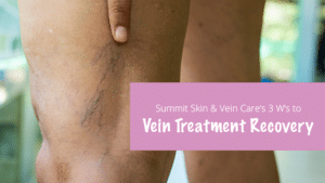 vein treatment recovery